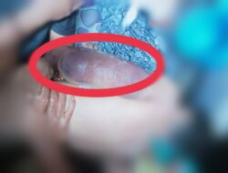 Kematian Pemuda di Ketapang Tak Wajar, Diduga Korban Penganiayaan oleh Petugas 